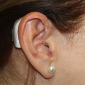 Hearing aid fitting ontop of the ear.